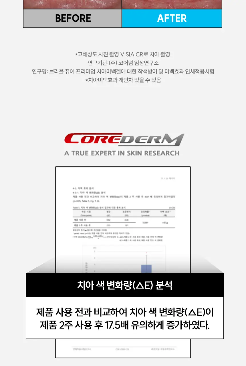 [NEW] 브리올 화이트닝 치아 미백제 4g (치과미백 동일성분) 상세페이지 7